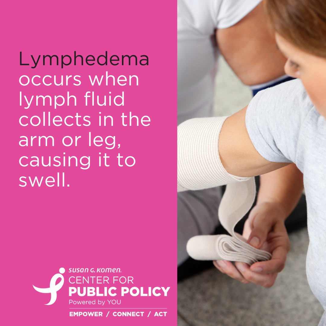 KomenMichigan's tweet photo. Lymphedema is commonly caused by the removal of or damage to lymph nodes, a problem many #breastcancer experience. Unfortunately, the supplies needed to treat lymphedema aren't covered by Medicare. Support the @LymphedemaAct to change this: https://t.co/UbUAPeCc9m https://t.co/D8VBS642dJ