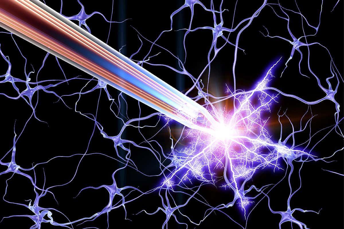 newscientist's tweet photo. Some women with severe anorexia have returned to a healthy weight and feel less anxious and depressed after having electrical devices implanted into their brains https://t.co/27NaJG0RV8 https://t.co/fCEb35K1jT