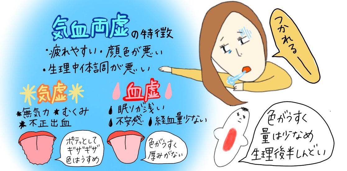 妊活姉妹 中医学zoom Sur Twitter 虚証 不足 タイプ 経血の色は薄くサラサラ 生理痛は強くはないが生理後もシクシク痛む 疲れやすい 目覚めが悪い ふらつく やる気が起きない 不安感 風邪をひきやすい このタイプは 休息 と 胃腸に優しい 妊活姉妹 中医学zoom Sur Twitter 虚証 不足 タイプ 経血の色は薄くサラサラ 生理痛は強くはないが生理後もシクシク痛む 疲れやすい 目覚めが悪い ふらつく やる気が起きない 不安感 風邪をひきやすい このタイプは 休息 と 胃腸に優しい