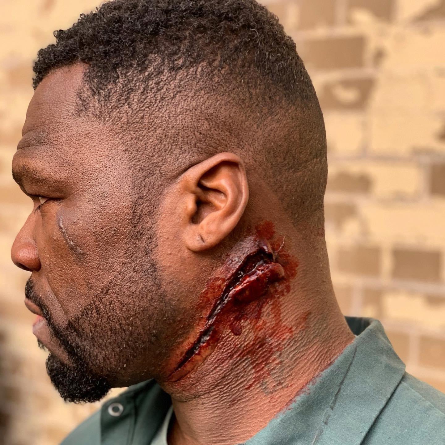 50 Cent Gunshot Wounds(05)