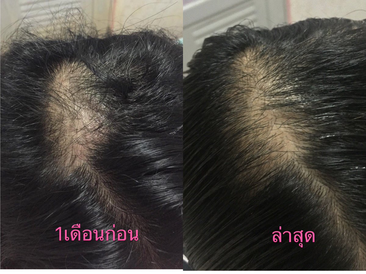 เพศแม่รีวิว tweet media