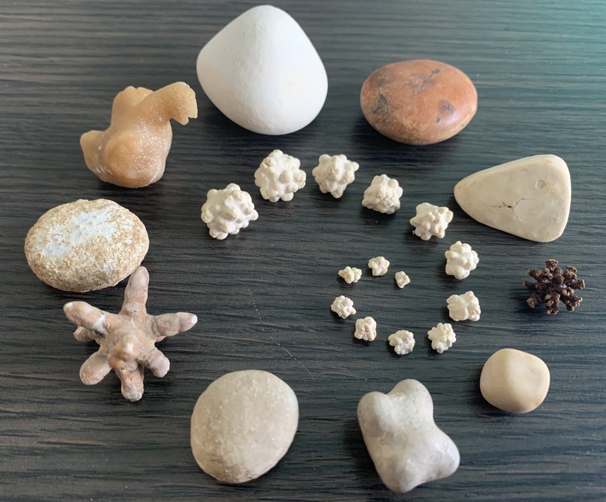 Pics#1: Urinary stones are so beautiful!
