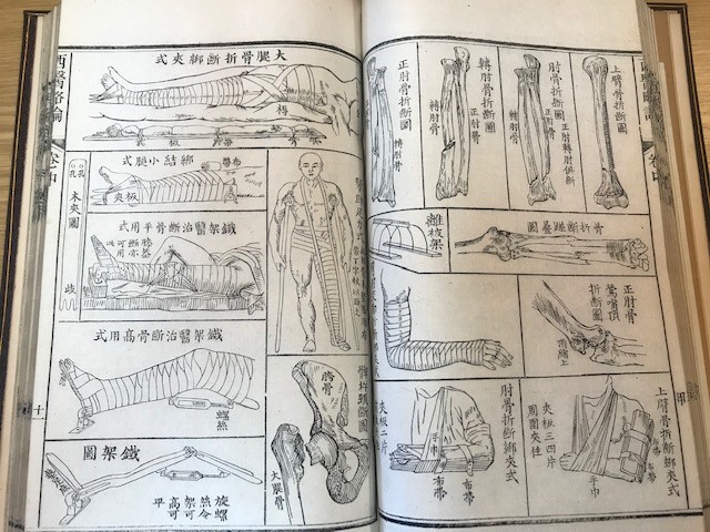 From #Chinese collection 15252.b.21: A short practical work of European Surgery. 3 volumes in Western binding, 1857. #medicine #BLisOpen