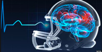 _itsmelliissaaa's tweet photo. It's critical that schools are accountable when it comes to concussions because some can cause serious injury to the brain if the force is extreme, so regular testing is a good start in addition to regulation of physical blows in the sport! #Ucr150 @MisssNallely @rabea_qamar https://t.co/tHUfOwoZV9