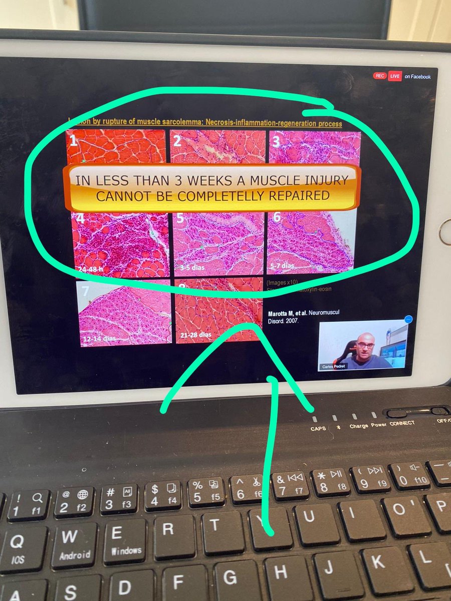 This is for all those <a href="/officialgaa/">The GAA</a> managers I have fought with over the years re player welfare and returning them to play! You know who you are 😜 #MasteringMuscles <a href="/sportsmapnet/">SportsMAP</a> <a href="/carlespedret/">carlespedret</a>