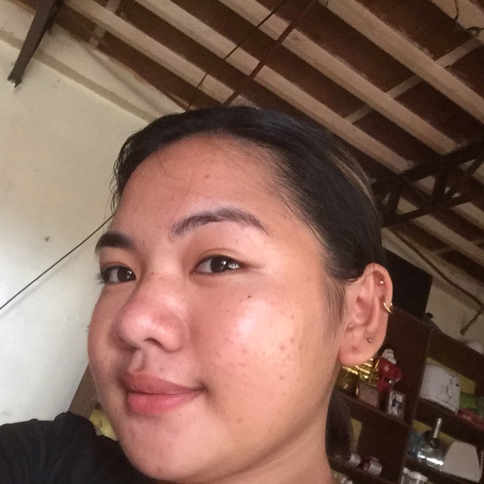 KeylyNunga2's tweet image. Di natin kailangan maging clear skin para gumanda🤗