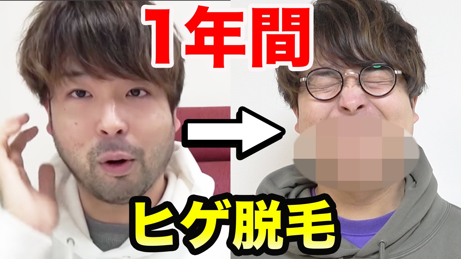 渋谷ジャパン おるたな 今日のおるたな 1年間の集大成 毛が濃い男が1年間ヒゲ永久脱毛に通った結果 T Co Reug8mz450 T Co Z9rebqdaxz Twitter
