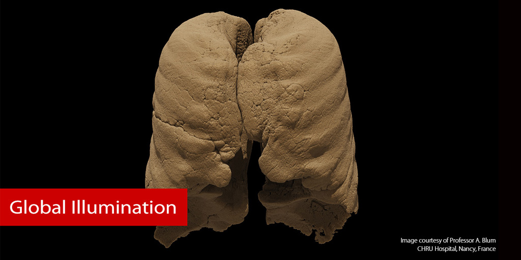 CanonMedicalEU's tweet photo. This is lung tissue like you’ve never seen. #GlobalIllumination: it's the new standard in advanced visualization. #MadePossible
For more astonishing images of Global Illumination: https://t.co/dN2Ek6rF93 
#advancedvisualisation #photorealistic #volumerendering https://t.co/54I1BuG6D5