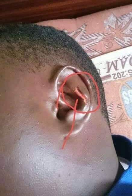 MarionKafuko's tweet photo. Mp @ZaakeFrancis brutally tortured by @PoliceUg @AKasingye @FredEnanga1 while in detention.
Crime: offering food to hungry vulnerable Ugandans .
Human rights violations must be condemned. @hrw
#COVID19
#FreeZaake https://t.co/nxLYyMso3j