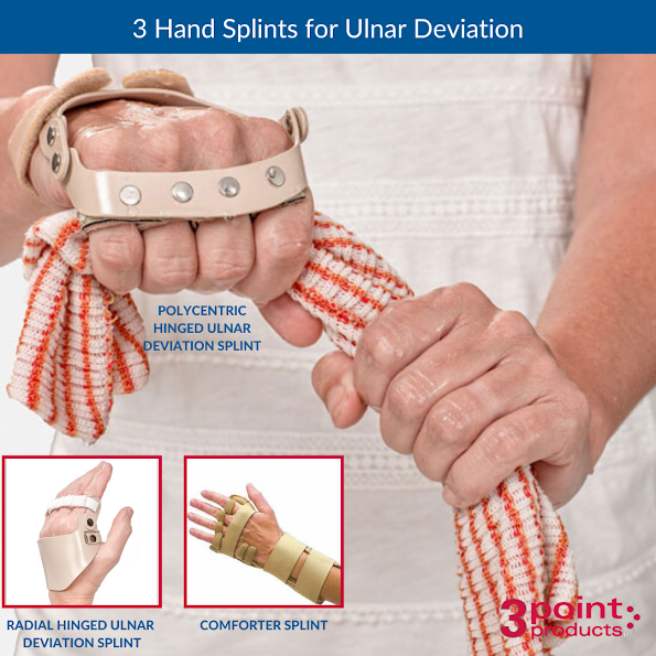 3PointProducts's tweet photo. The primary cause of Ulnar Deviation is Rheumatoid Arthritis. Learn more about treatment options in our recent blog, "3 Hand Splints for Ulnar Deviation" -  https://t.co/90aaWorZlc https://t.co/0KUW0vIjhw