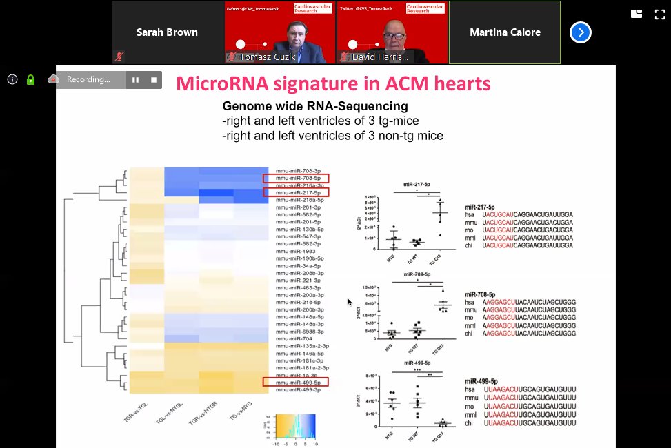 Live from #CardiovascularResearch Virtual Session: Dr Martina Calore shares her recent work in Wnt signalling and miRNA dysregulation in arrhythmogenic #cardiomyopathy and what's next for her research More: bit.ly/2YfISvW @ESC_Journals @escardio @MaastrichtU #CVD #ACM