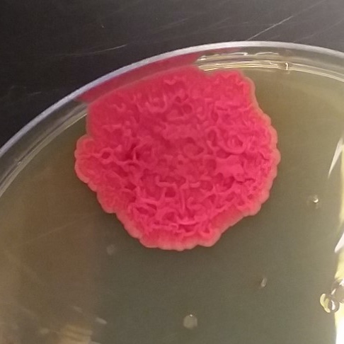 <a href="/Social_Biofilms/">The Social Biofilm Network</a> Here's a fun contaminant/lab pet unearthed from the 4C during our last lab cleanup day! <a href="/ContamClub/">Contamination Club</a>