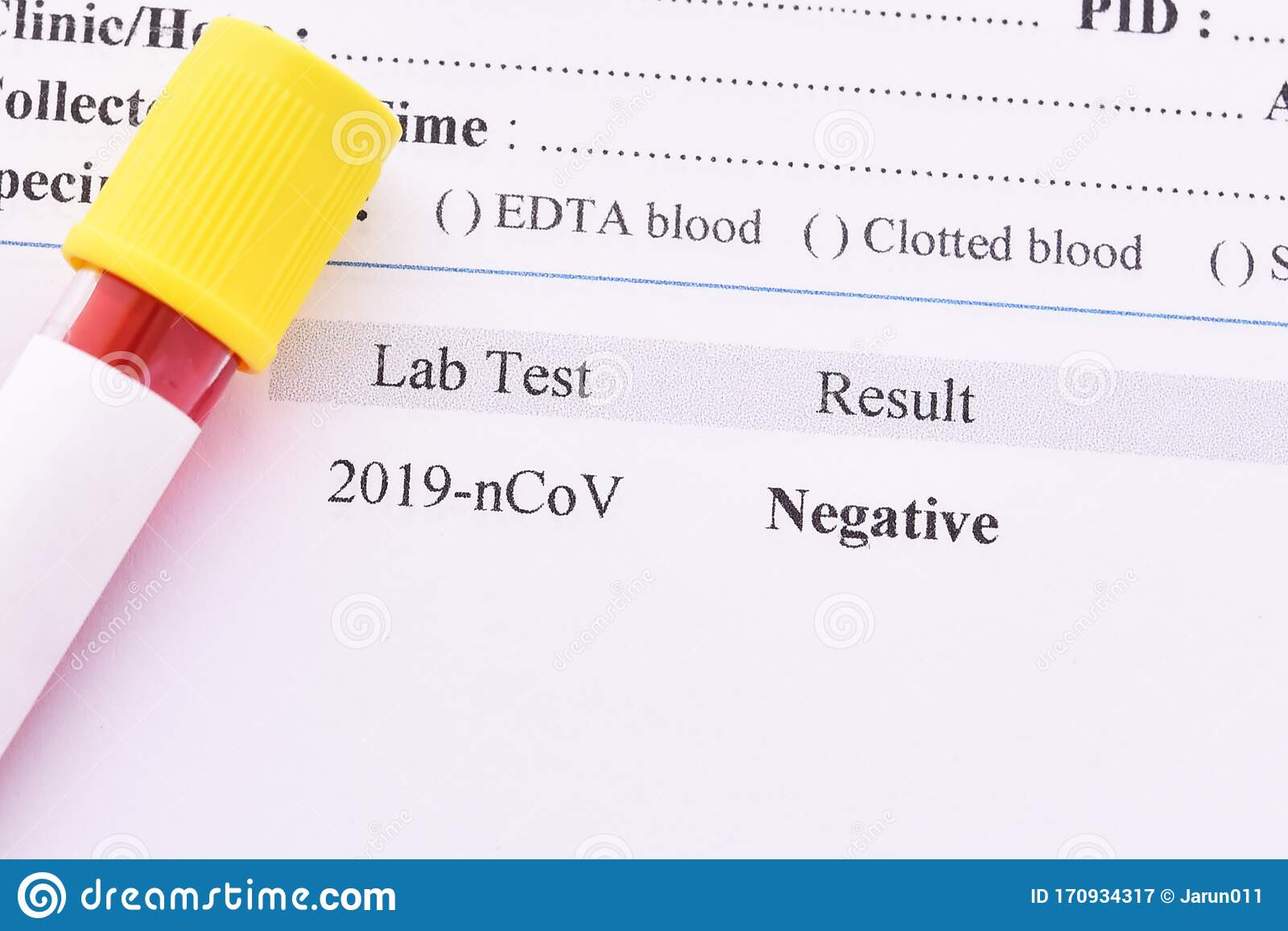 Negative covid test 是 什么 意思