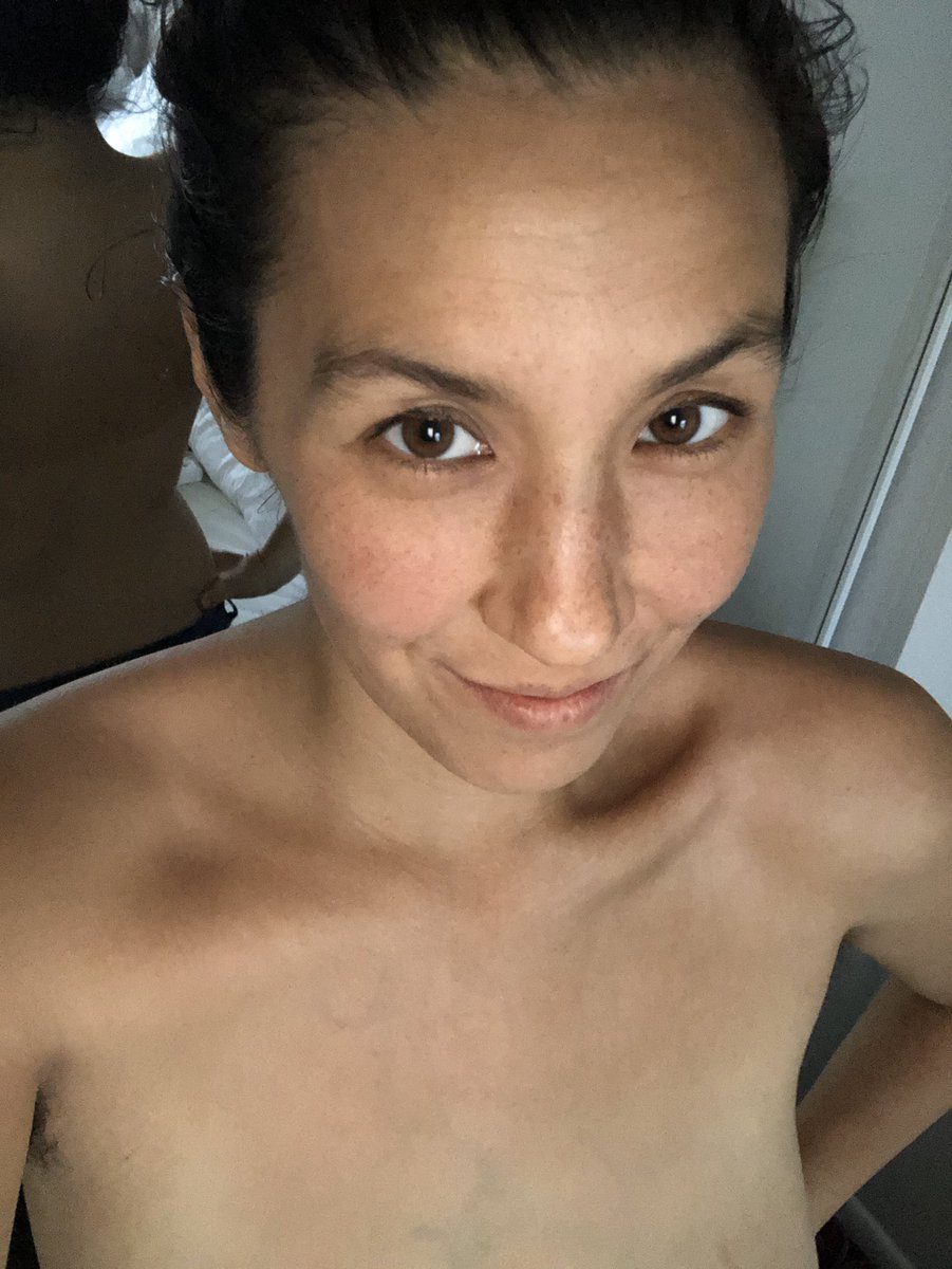 kumiomori's tweet photo. Back tan line😂
#vitamind #sunshine #outdoors #pittens https://t.co/FtjqxKov9V