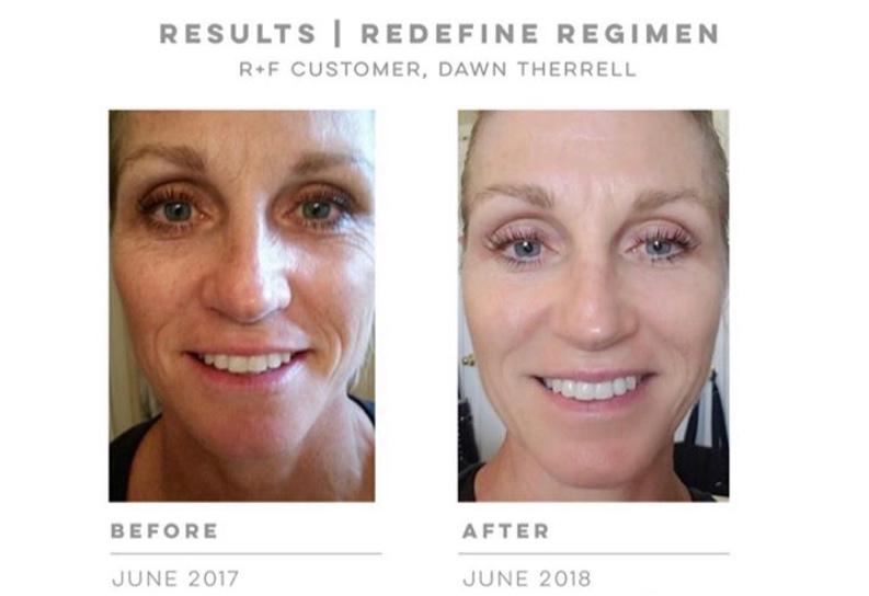 Mother’s Day gifts ideas? Rodan &amp; Fields has what you looking for! #rodanandfields #begorgeous2day #positivevibes #SelfCare #quarantine #radiantdefense #lifechangingskincare #lovetheskinyourein #lashboost #rodanandfieldsconsultant #skincare #sensitiveskin #mothersdaygiftideas