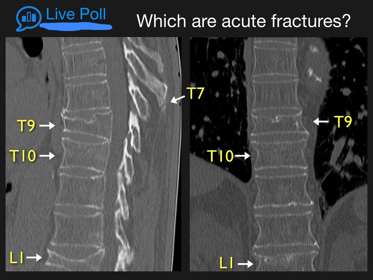 Featured image of post Radiopaedia Org App A free online collaborative radiology resource