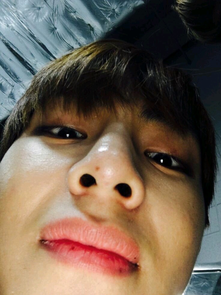 taehyung's lil mole in his nose; a devastating thread