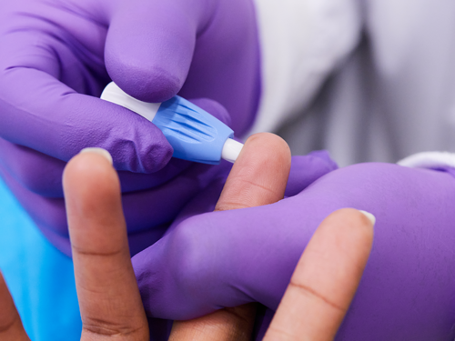 Labcorp's tweet photo. LabCorp Employer Services is supporting U.S. companies in returning to work by offering employee questionnaires, temperature screens, employer worksite and off-premise #COVID19 testing collection, and our new fingerstick IgG #antibody blood test. More: https://t.co/m9nI6cXtyG https://t.co/6PBRnVesF4