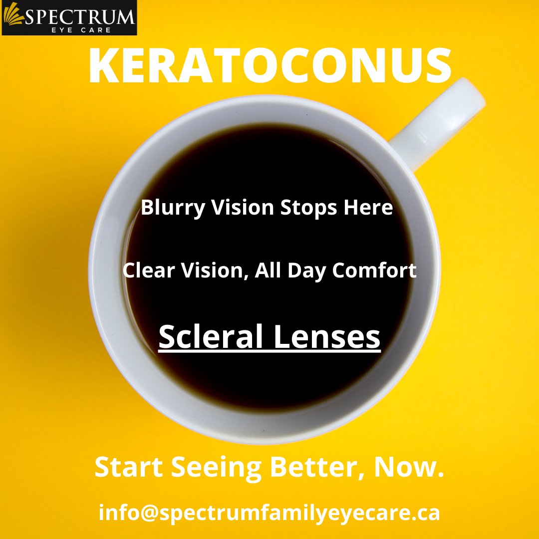 Spectrum_EC's tweet photo. Start seeing better, now! Book your fitting, info@spectrumfamilyeyecare.ca
#keratoconus #keratoconushamilton #scleral #scleralhamilton #hamiltoneyedoctor #hamiltonoptometrist #spectrumeyecare #spectrumfamilyeyecare https://t.co/P8RF4eS55b