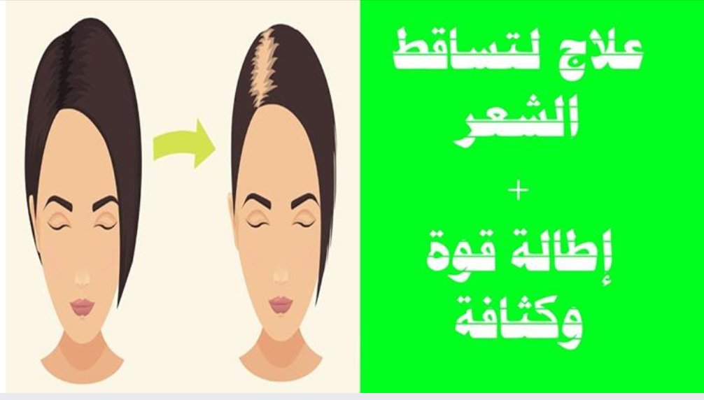 sokatv04's tweet photo. #كيفية تحضير #زيت #الشعر #السحري والطبيعي ل#منع #تساقط_الشعر زائد طول #كثافة وقوة 1×4
https://t.co/FVVlJRp7Im
#العناية_بالشعر  #وصفة #تطويل_الشعر #إطالة_الشعر #تكثيف_الشعر #كثافة_الشعر #قوة_الشعر  #طول_الشعر #تقوية_الشعر #الشعر_الجاف #الشعر_الذهني #تقصف_الشعر #وصفات_طبيعية_للشعر https://t.co/6hcsQvhgKU
