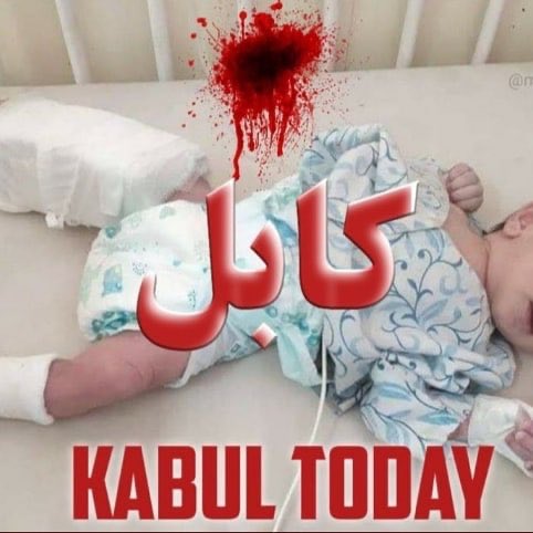 dehsabzi's tweet photo. The newborn baby was hospitalized after suffering a concussion to his right leg.
Damn the war!
#bobmattack #kabul #Afghanistan #UnitedNations #worldright #HumanRights #humanity #ashrafghani #police #pray #Peace #رمضان_كريم https://t.co/wlHc43XXsp