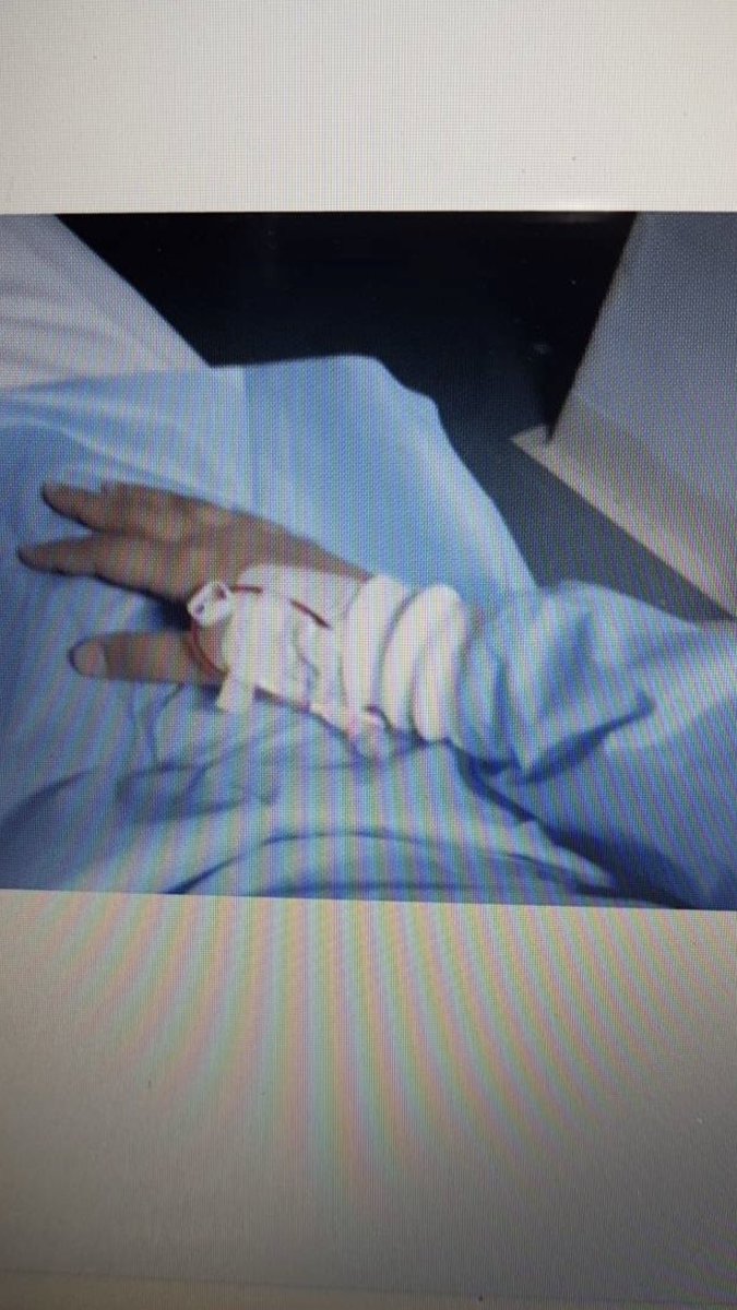 ShoodiB's tweet photo. 12/5/2020 #iMed20
الحمدلله الذي بنعمته تتمّ الصالحات
اليوم كان آخر اختبار لي في كلية الطب♥️👩🏽⚕️
والله إنها كانت سبع سنين عجاف ولكن يسرها الله بفضل منه ثم بدعاء والديّ.
انا اليوم أكثر أنسانة فخورة في نفسي وإنجازي ،إني دخلت الجامعة وأنا مريضة وتخرّجت منها طبيبة رغمًا عن كل الظروف https://t.co/SzloNMtawZ