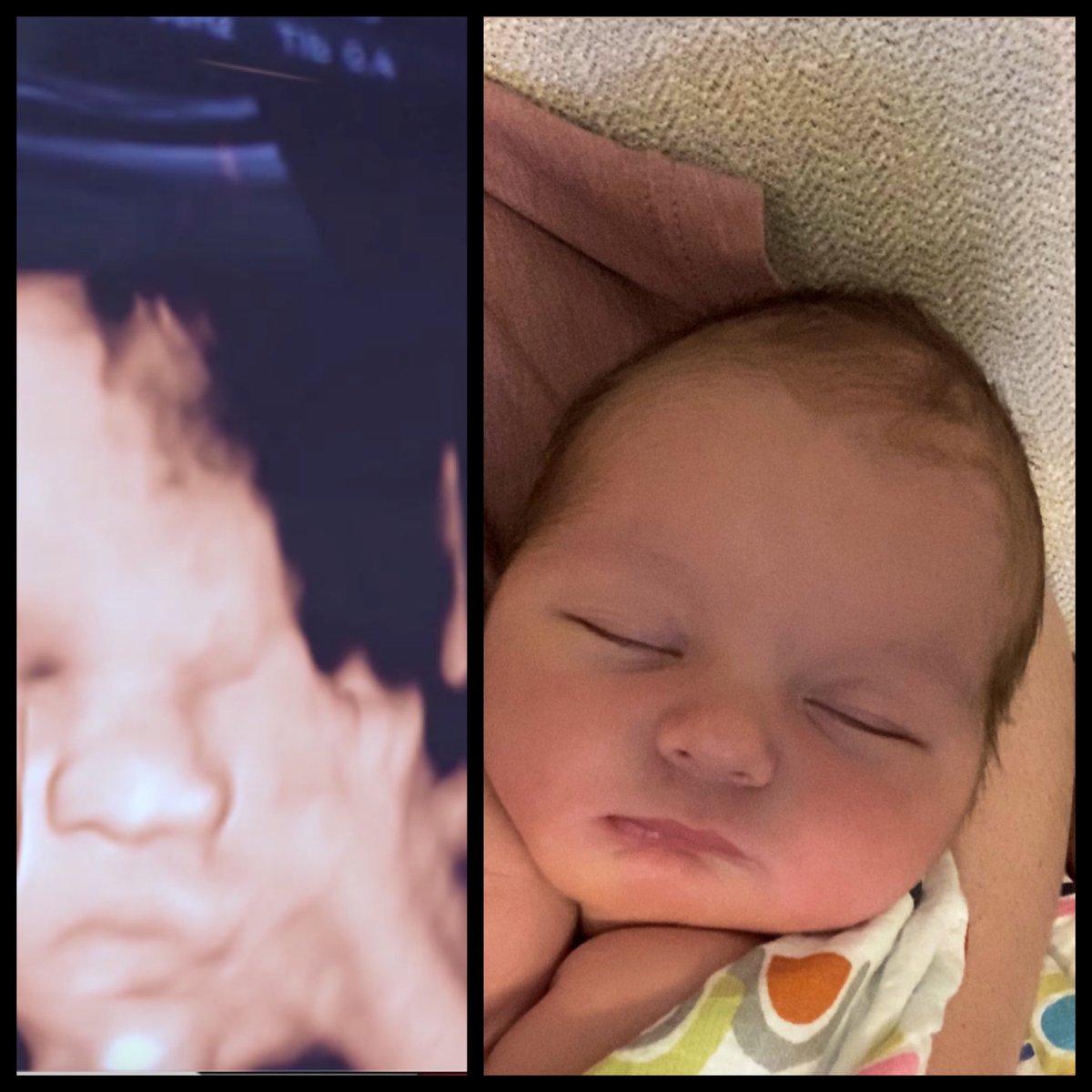 BabyScene1's tweet photo. baby. model.⁣
⁣
this little guy captured our hearts at our photo shoot of his model mama during her sonogram.⁣

813.382.1400⁣

#babymama #littlemodel #mamamodel #4dultrasound #4dultrasoundtampa #4dultrasoundtampabay
⁣ https://t.co/nB6gJTLZPn