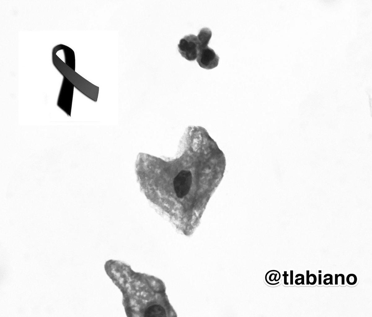 tlabiano's tweet photo. Estamos en la fase1 desde ayer, podemos salir,hacer deporte, pasear... Intentando volver a la “normalidad”. ¡Pero no hay que olvidar!Han sido unos días duros y tristes y detrás de las estadísticas y los números hay gente que no tenía que irse... 🖤🇪🇸#stayalert #staysafe #COVID19 https://t.co/w6CKMVgWRR