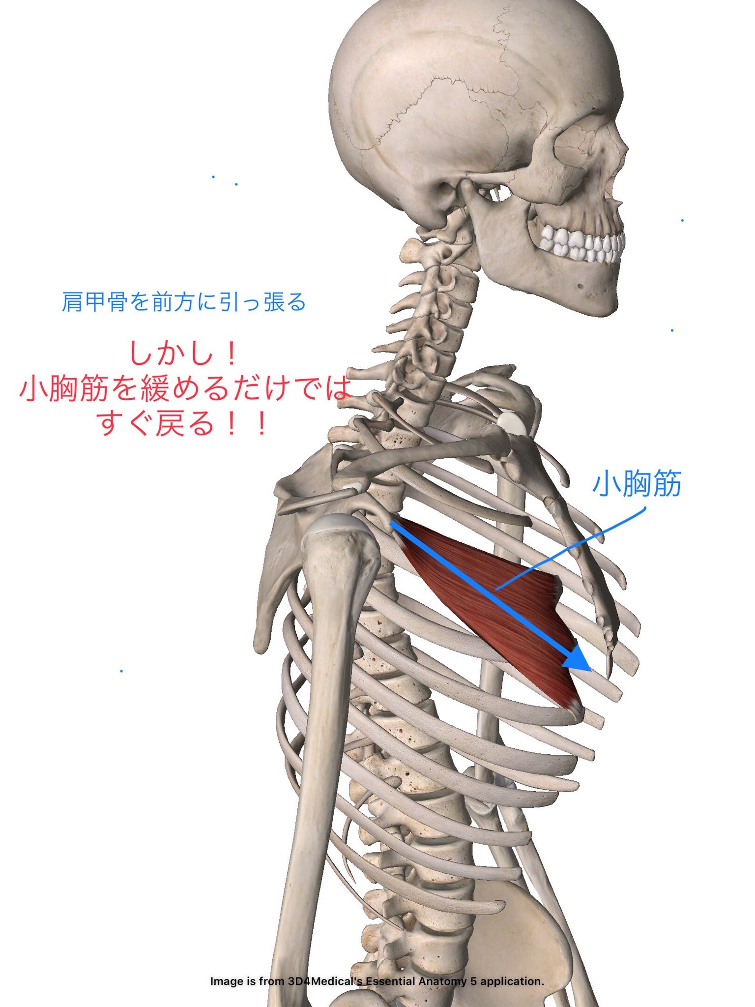 鈴木孝佳 姿勢改善の専門家 Twitter ನಲ ಲ 小胸筋が緊張すると 肩甲骨が前に出てきます しかし ストレッチなどで緩めるだけでは絶対に改善しません 脳は 能動的に動かさないと学習しない のです 緩めればなおるはウソです 一時的には変わる 小胸筋が