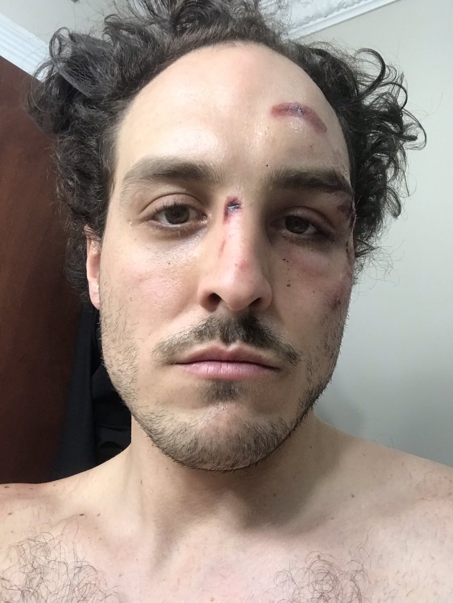 MCaveman123's tweet image. @BrendanSchaub #ThiccBoyyBikeClub #NYChapter #EastCoastDivison got the #UFC #DayAfterAFightLook. Hit on my bike ridin doing deliveries. Can’t do them now for a while #ITookIikeAChamp #MyBikeIsDead