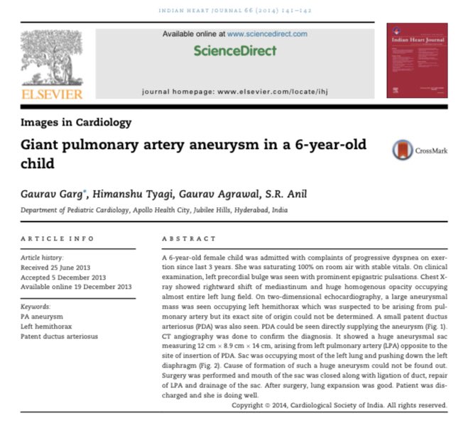 cardiopedhnn's tweet image. Este es otro caso de un enorme #aneurismaarteriapulmonar izda asociado con una PCA en una 🧒de 6 años de causa no determinada. 

👉doi.org/10.1016/j.ihj.…

Además, se adjunta artículo de revisión de Aneurismas Pulmonares. 

👉doi.org/10.1161/CIRCUL…

#echofirst #whyCCT