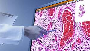 Pathology_2020's tweet photo. @Pathology_2020 
#Digital #Pathology
#OnlineConference

Visit: https://t.co/UMa0Rre93o to know more about the conference &amp; submit your #Abstracts at: https://t.co/B5gUiCmO9y to make your slot confirm

#pathology #conference #digital #path #science #medical #research #doctors #bio https://t.co/QHbTS27O1A