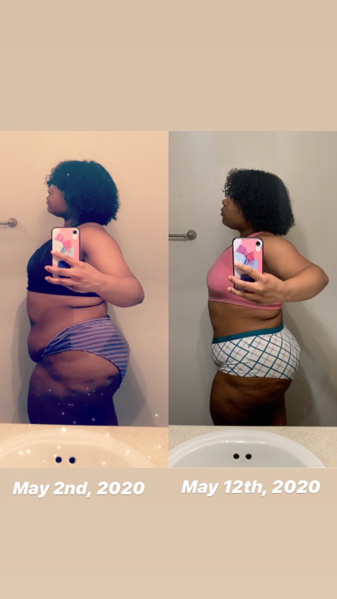 KaeKaesCorner's tweet photo. Back with another update.
10 day difference😳🥵🔥💪🏾
🗣STOP PLAYING WITH ME❗️❗️❗️
Total Life Change Products used: “The Get Fit Kit”
-Iaso tea
-NRG Pills
-Nutraburst
#kaekaescorner #letmetalkmyshit #soboom #thereallifedoctor #iasotea #weightloss #totallifechange #nutraburst https://t.co/n0I3BFV6KX