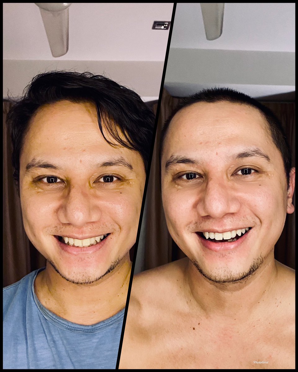 carrmalrahim's tweet photo. Before and after #selfshave https://t.co/ezSEL8aSn3