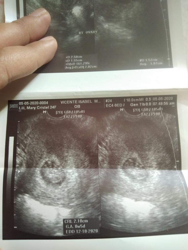cristel_lili's tweet photo. I will never forget you my little Angel. Mommy will always love you so much!. You will always be my little baby. I miss you so much. I'm so sorry , Im so sad that I lost you
#RipMyBaby
#BabyJC https://t.co/ufEZ5PIbss