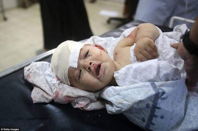 NajmiFactor's tweet photo. Hello World 
Are you still sleeping?
Oh, I understand
This is not a news for you.
Because it happened in Afghanistan and this is the blood of innocent Afghan children
#kabulattack https://t.co/m2KCzepTu5