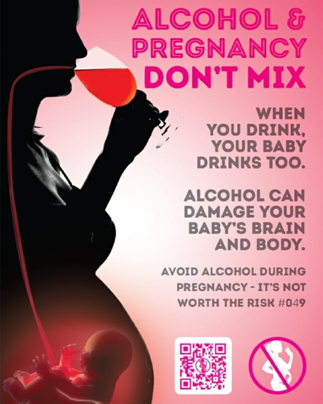 When you drink your #baby drinks too.
#AvoidAlcohol during pregnancy🚫🍷🤰
#alcoholresearch #alcoholspectrumdisorder #fasd #NOFASD #afasaf #teaf #noalcoholduringpregnancy #avoidalcohol #0alcohol #niunagotamás #teaf #fasdcanda #dontdrink