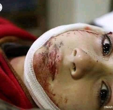 inamullahwaxir's tweet image. #EndofHumanity 
Those who has attacked the hospital, they are worse than beasts even. I strongly believe that even beast would not commit such acts. I  humanity has come to it&apos;s end. 
#AfghanistanHospitalAttack