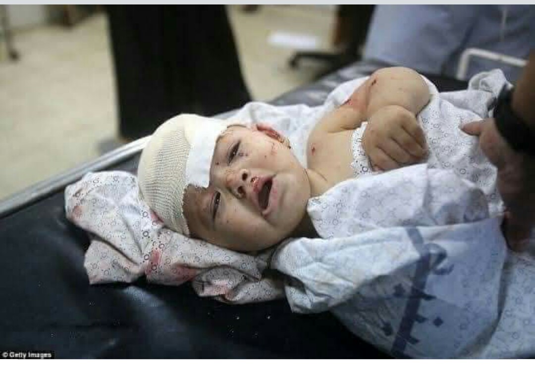 inamullahwaxir's tweet image. #EndofHumanity 
Those who has attacked the hospital, they are worse than beasts even. I strongly believe that even beast would not commit such acts. I  humanity has come to it&apos;s end. 
#AfghanistanHospitalAttack