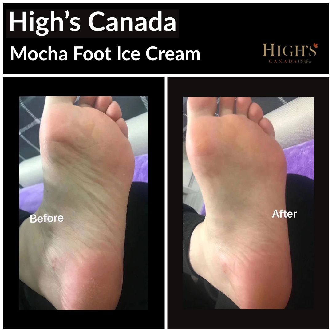 Highs16's tweet photo. Our Mocha Foot Ice Cream Before &amp; After
Maximum Moisture Replenishment

Try it Today
https://t.co/wyTuKQFgBy

#highscanada #highsbeauty #footcream #DIY #mocha #nourishing #jojoba #oliveoil #johobaoil #sheabutter #vitaminE #skincare #footmoisturizer #pedicure #icecream #softens https://t.co/gNy8xlZvaN