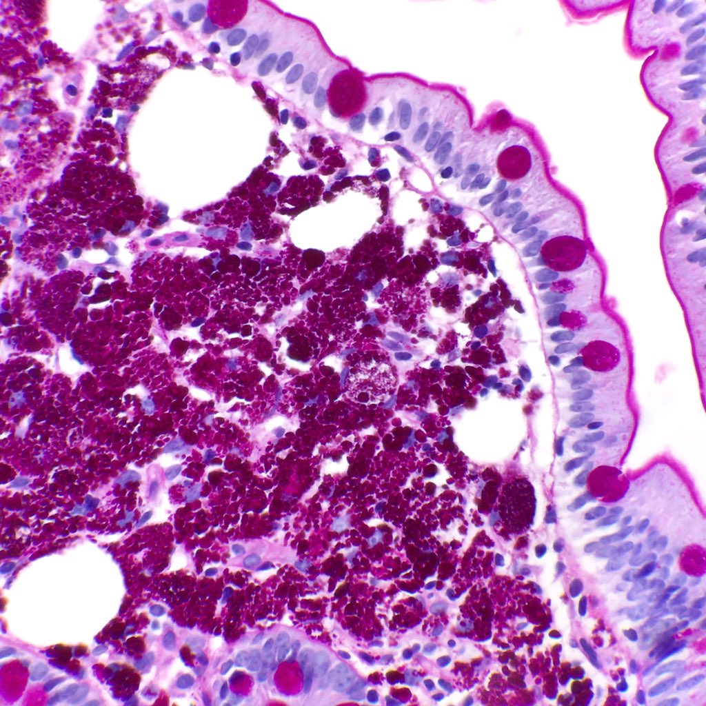 Michael Feely, DO tweet media