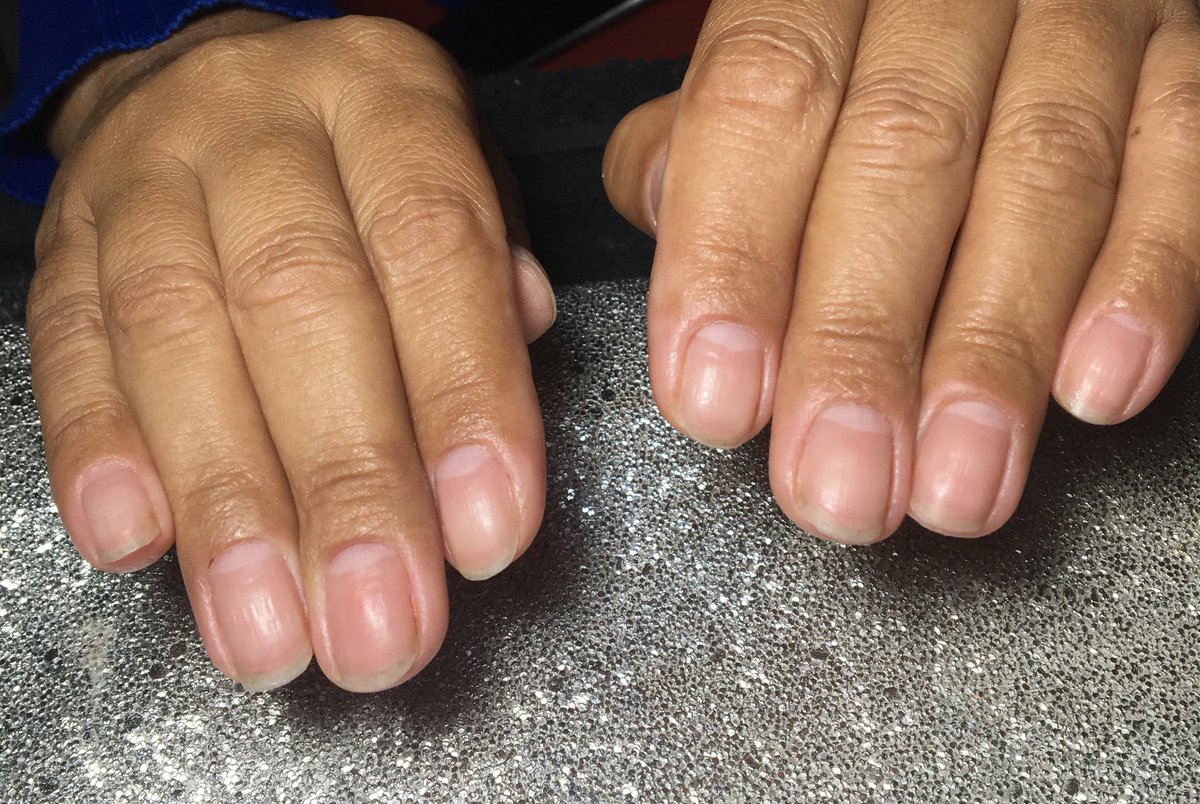 icnailsdesigner's tweet photo. Delicadeza em forma de nails! 💜
#ILoveNails #NailsDesigner #Cutilação #Square #Acrigel #Floral #UnhasRuídas #Vinho #UnhasDelicadas #ManicurePorAmor #AcrigelFormatos #Square #encapsulada #SpiderGel #UnhasAcrilicas #acrilicnails #lixamentotecnico https://t.co/YhkbwQCxpN