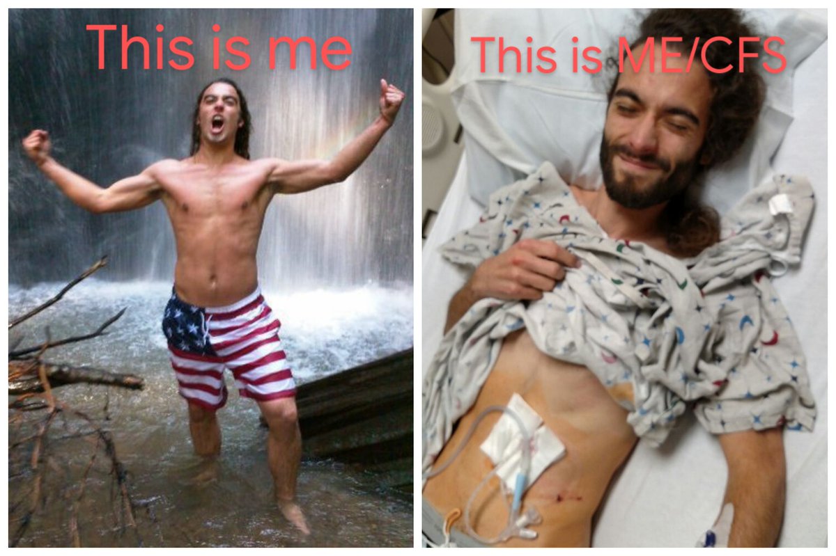 CrippleCouple's tweet photo. Ten years ago I did 20+mile hikes, jumped in waterfalls on a whim.

Today I can't even eat, let alone hike, work or go back to school.

I am one of the #MillionsMissing

#MECFS #ME #CFS #tubie #gastroparesis #chronicFatigueSyndrome #MyalgicEncephalomyelitis #ChronicIllness https://t.co/flKreweFG4