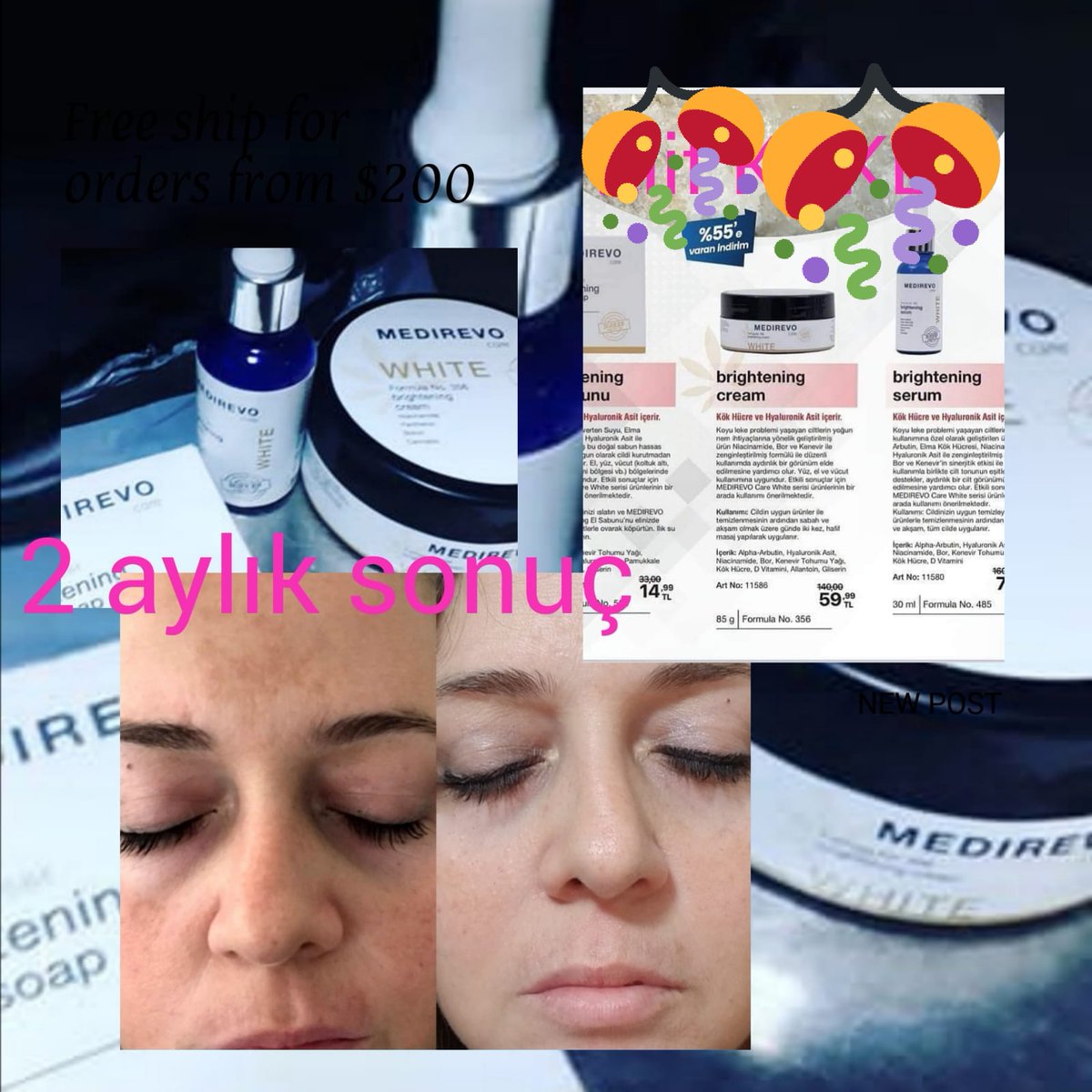 dogum lekesi cilt lekesi gunes lekesi olan kisiler mutlaka deneyin %100 sonuc...#ersin #ersinkorkut #dogumlekesi #ciltlekesi #guneslekesi #ciltbeyazlatma