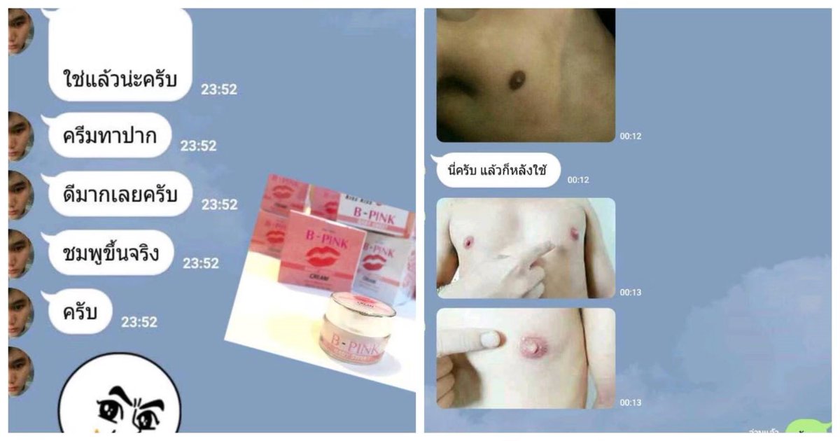 PriteWitsanu's tweet photo. เปล��่ยนจาก ปากคล้ำ นมดำ ให้เป็นสีชมพู แบบถาวรใน 1 สัปดาห์

B-Pink
ครีมทา ปาก และ นม ชมพู
ที่ผมเองกล้าการันตี ผล ใช้เอง ขายเอง รีวิวเพียบเลย ขายดีม๊ากกกก

สักทำไมให้เจ็บตัว ใช้เลย เพียง 390.-

สนใจ line pritehotie https://t.co/5YQ3SSvZBq