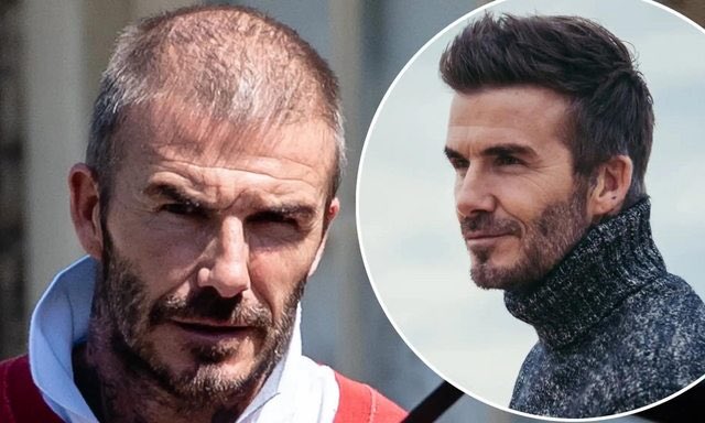 あのデビッド ベッカム 急激に老けてしかもハゲる Matomehub まとめハブ