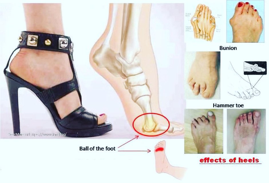 Thanks to @heels.everyday #platformheels #killerheels #7inchheels | Heels,  Hot high heels, Fashion high heels