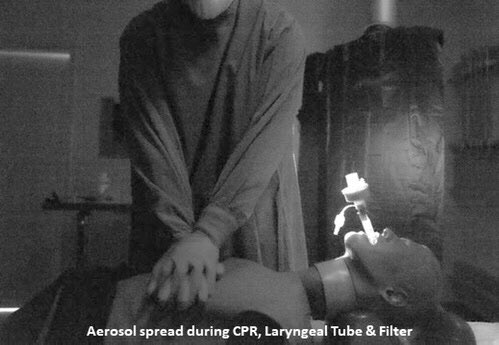 Strategies to reduce #aerosol spread during chest compressions #cpr in #COVID19 pts. Just published in resuscitation. Laryneal tube w/ filter may protect our staff #airway #m4mvscovid 

resuscitationjournal.com/article/S0300-…