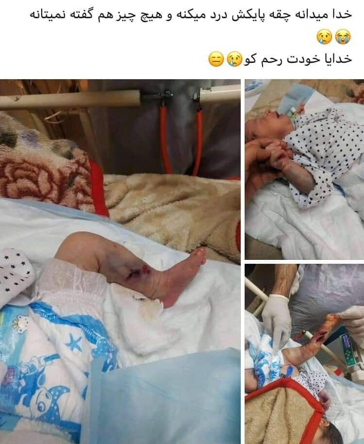 HejranRaha's tweet photo. The Terrorist Taliban kill everyone, no matter they are kids, adults or elders, they kill women and men. I don't know, why the countries, human rights and UN is silent?
In their last attack on a maternity they brutally killed babies, mothers and adults. 
#KilledMothersWithBabies https://t.co/Yx84dRmzXA