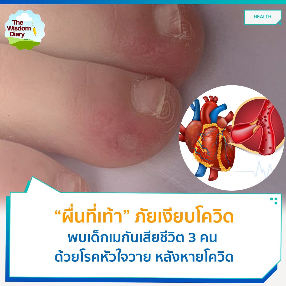 ไดอารี่คนมีความคิด tweet media